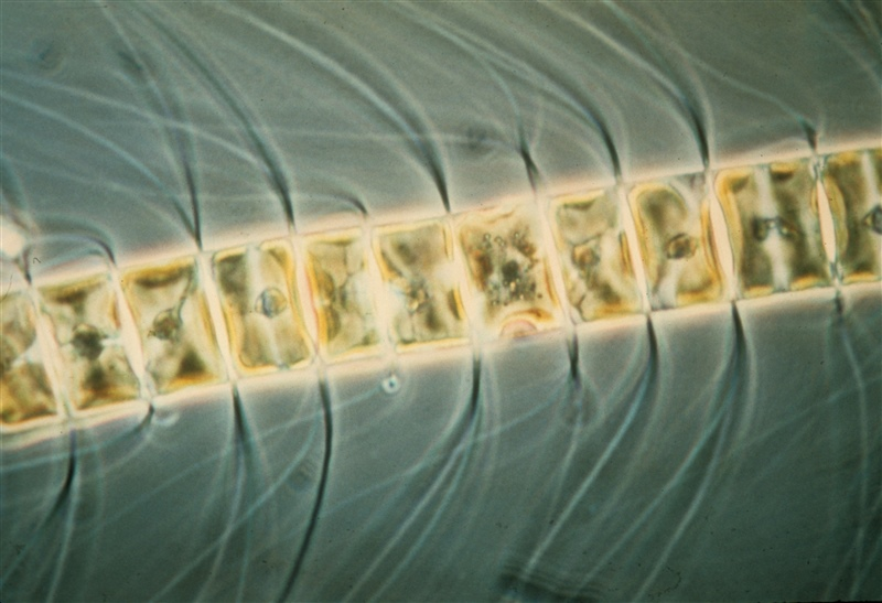 Microscopic view of a marine phytoplankton species (Chaetoceros sp.)